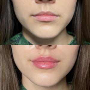 2b9be54c-4c92-4dad-aa9a-0f72c9d590a5