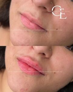 london_cosmetologist.elya (1080 x 1350 пикс.).jpg-2