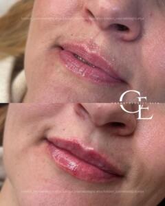 london_cosmetologist.elya (1080 x 1350 пикс.).jpg