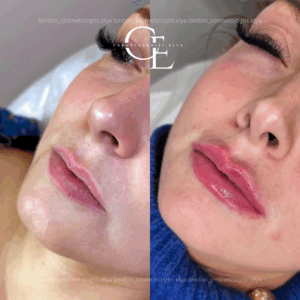 london_cosmetologist.elya (Публикация в Instagram).png